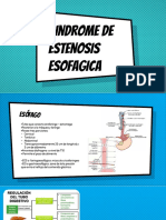 estenosis esofagica.pdf