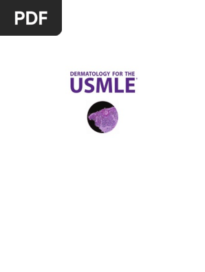 Dermatology For The Usmle Cutaneous Conditions Skin