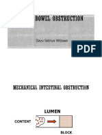 Ileus and Bowel Obstruction