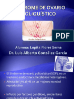 Ovariopoliquistico 111204001639 Phpapp02 PDF