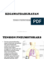 4. Kegawatdaruratan Tension Pneumotoraks