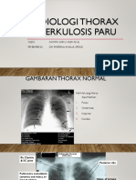 Radiologi Thorax Tuberkulosis Paru