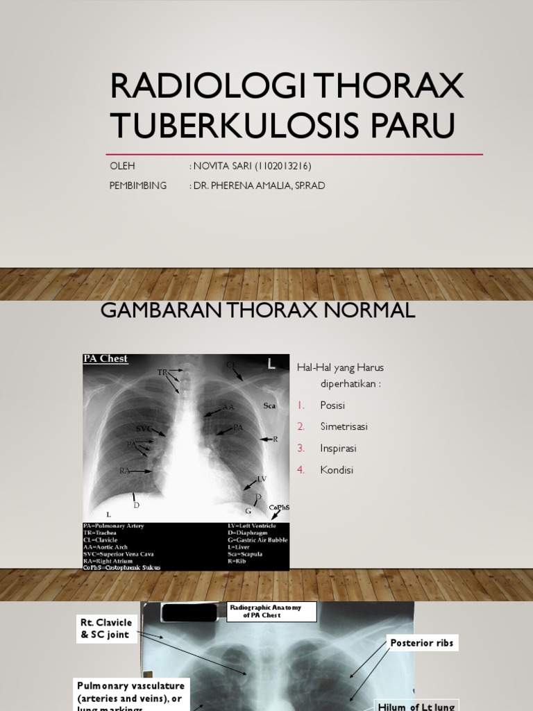 Radiologi Thorax Tuberkulosis Paru | PDF
