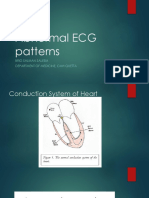Abnormal ECG Patterns: Brig Salman Saleem Department of Medicine, CMH Quetta