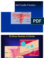 Cáncer de cérvix: causas, síntomas, diagnóstico y tratamiento