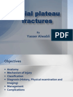 Tibial Plateau Fractures: Yasser Alwabli