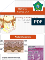 Nevus Ota