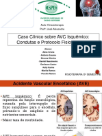 Protocolo de Cinesioterapia para AVC Isquêmico