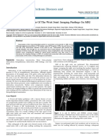 Tuberculous Tenosynovitis of the Wrist Joint Imaging Findings on Mri 2332 0877 1000307