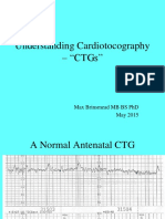 Understanding Cardiotocography - "CTGS": Max Brinsmead MB Bs PHD May 2015