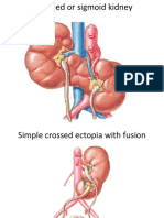 Kidney, Ureter, Bladder & Urethra Conditions