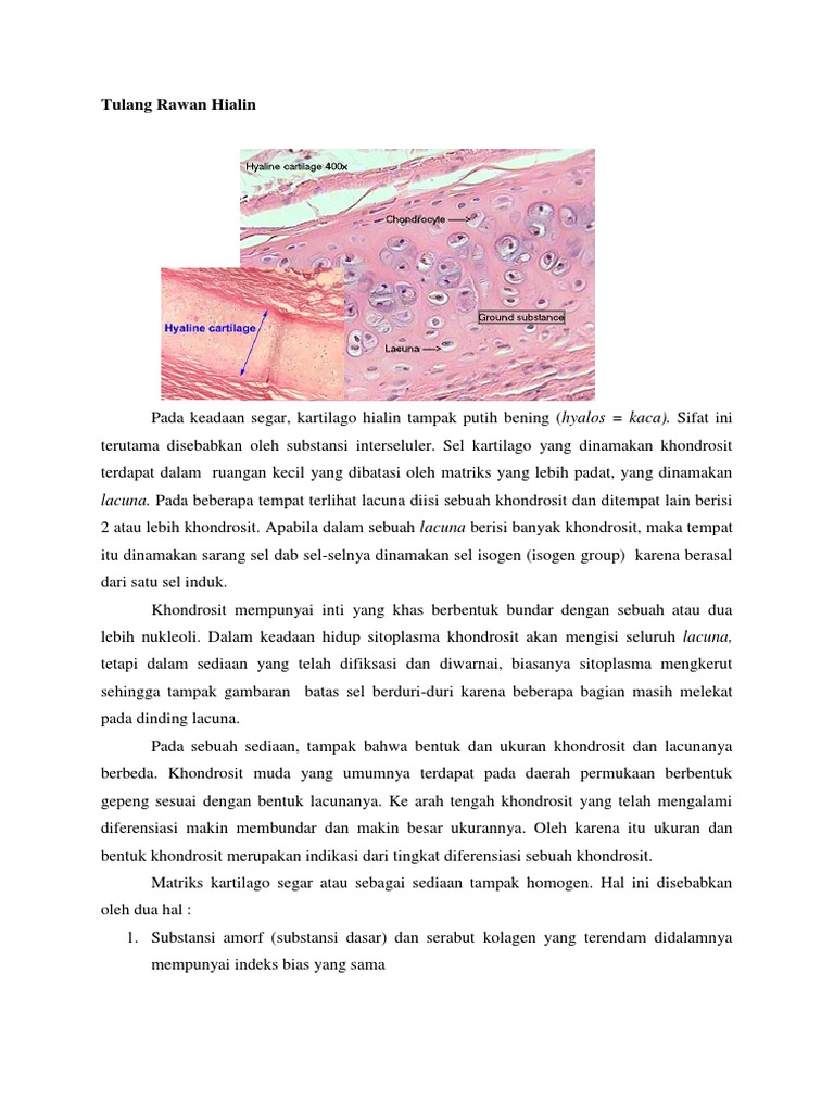 Tulang Rawan Hialin