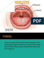 Tonsilitis