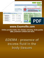 Edema