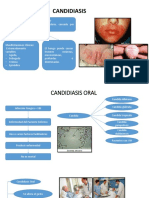 Candidiasis Oral