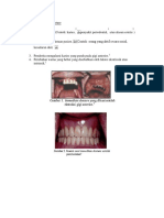 Indikasi dan Kontraindikasi Immediate Denture