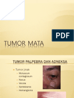 Tumor Mata