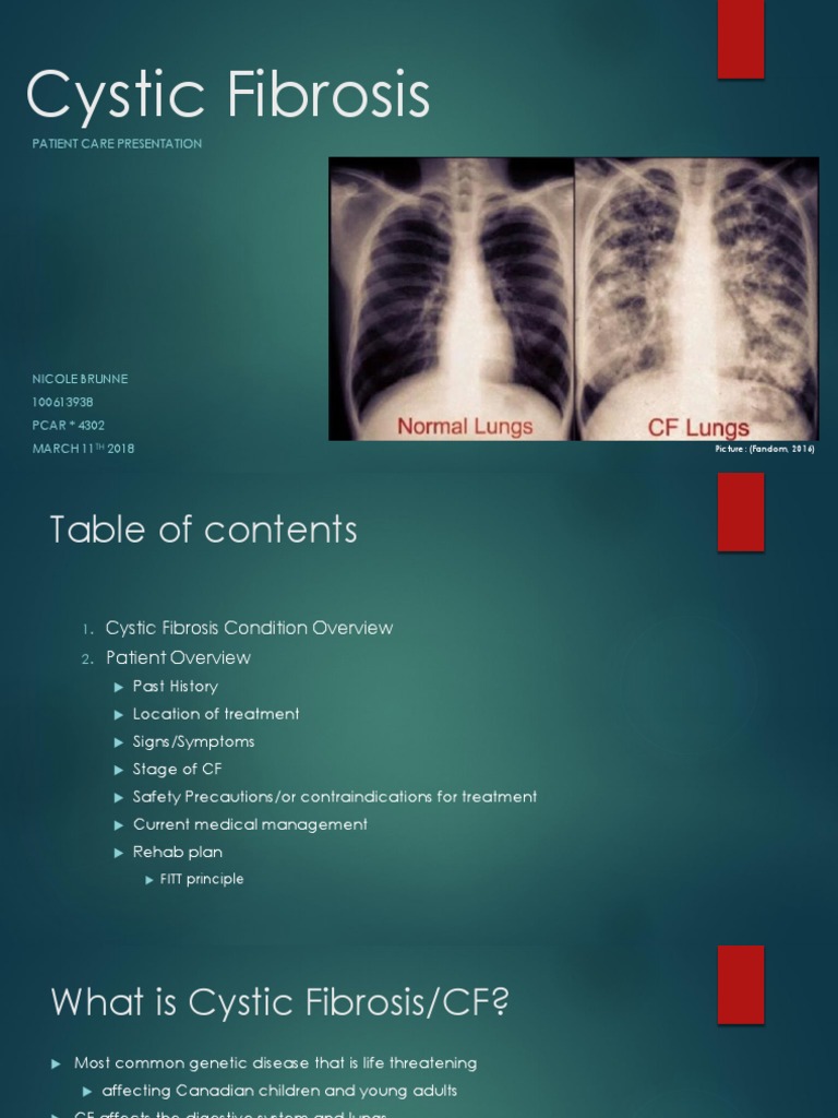 presentation of cystic fibrosis