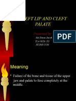 Cleft Lip and Cleft Palate