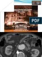 Abdominal Aortic Aneurysm