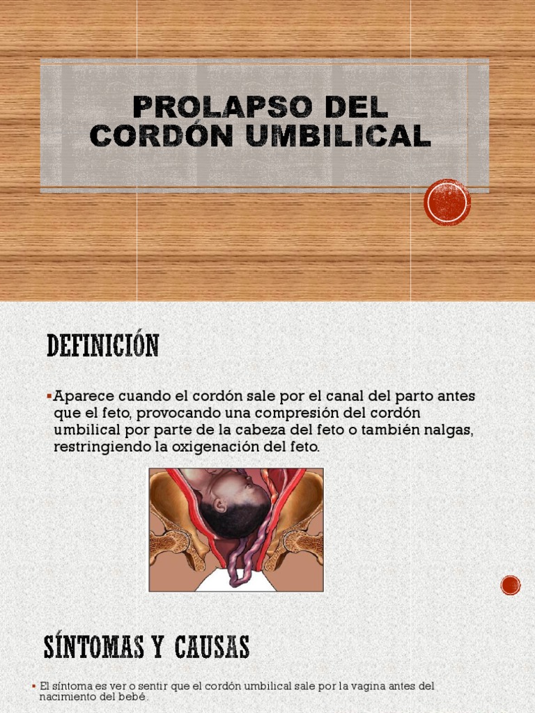 Prolapso Del Cordón Umbilical PDF Feto Parto