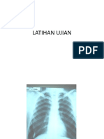 Radiologi Soal1