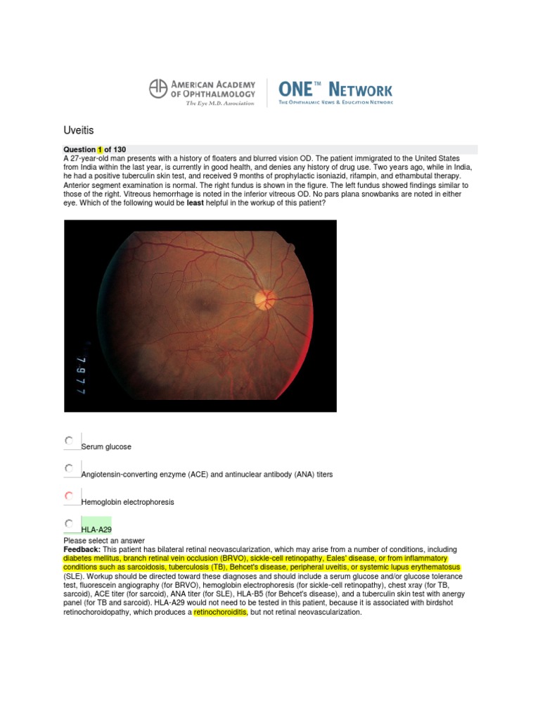 Uveitis Diagnosis and Management Insights | PDF | Vision | Health Sciences