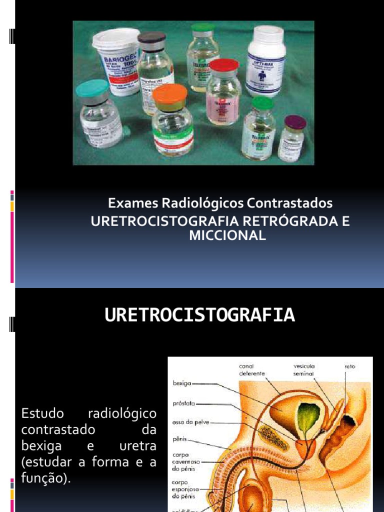 Aula 2 - MC - Uretrocistografia Retrógrada e Miccional | PDF