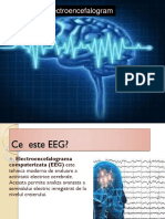 Electroencefalogram A