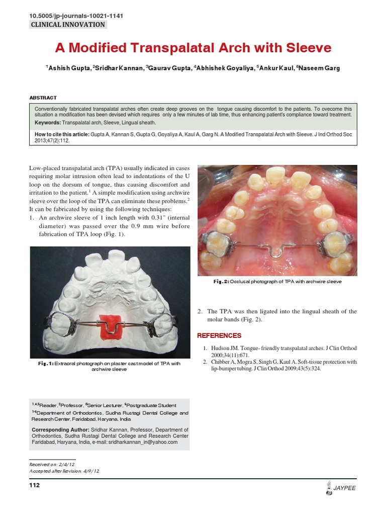 A Modified Transpalatal Arch With Sleeve Mouth Orthodontics