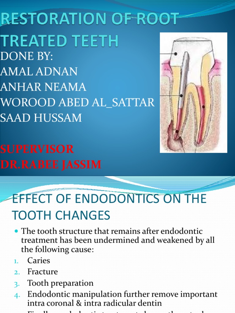 Restoration of Endodontically Treated Teeth | PDF | Human Tooth | Tooth