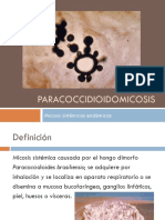 Paracoccidioidomicosis