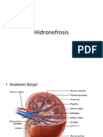 Hidronefrosis.pptx