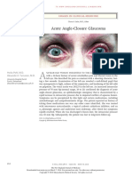 Acute Angle-Closure Glaucoma