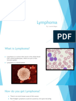 lymphoma - health