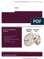 Alzheimers Disease Presentation