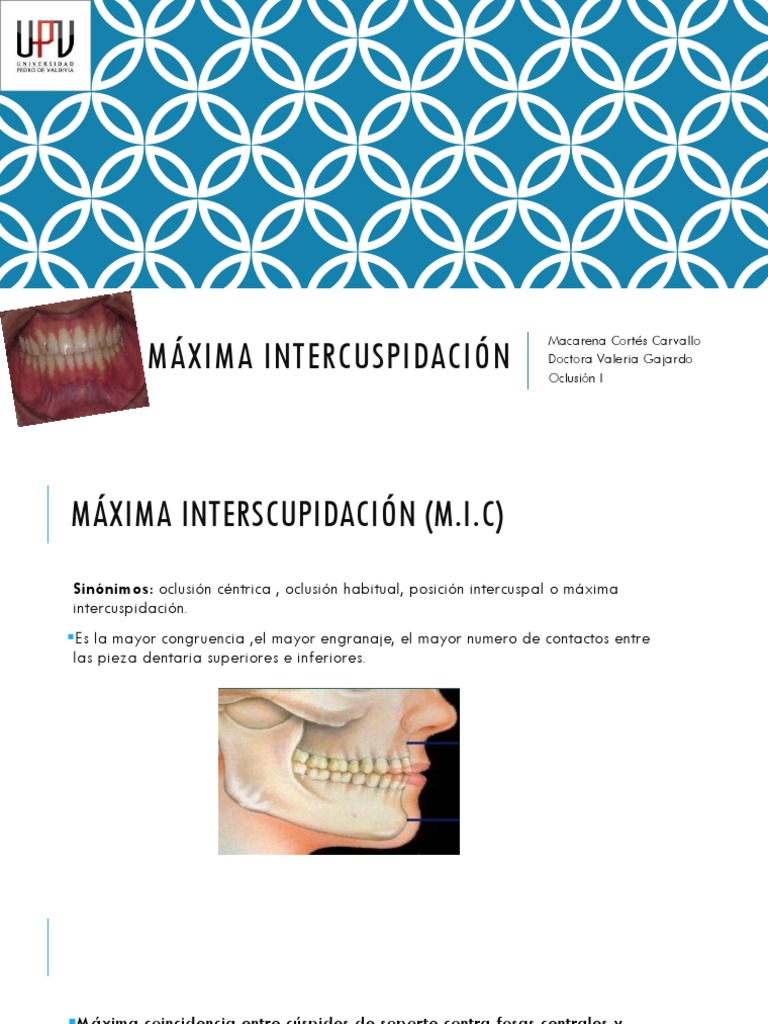 Definición de Máxima Intercuspidación | PDF