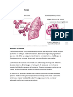 Descripción General: Fibrosis Pulmonar