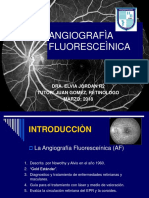 Angiografía Fluoresceìnica