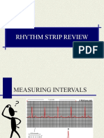 Basic Rhythm Strip Review 1226365348197587 9 1