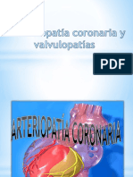 Arteriopatía Coronaria y