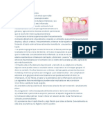 Definición y causas de la pericoronaritis
