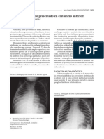 Tuberculosis Pulmonar: Descripción Del Caso Presentado en El Número Anterior