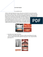 Indikasi Dan Kontrindikasi Dental Implant