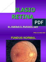 Ablasio Retina