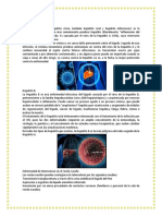 Hepatitis A