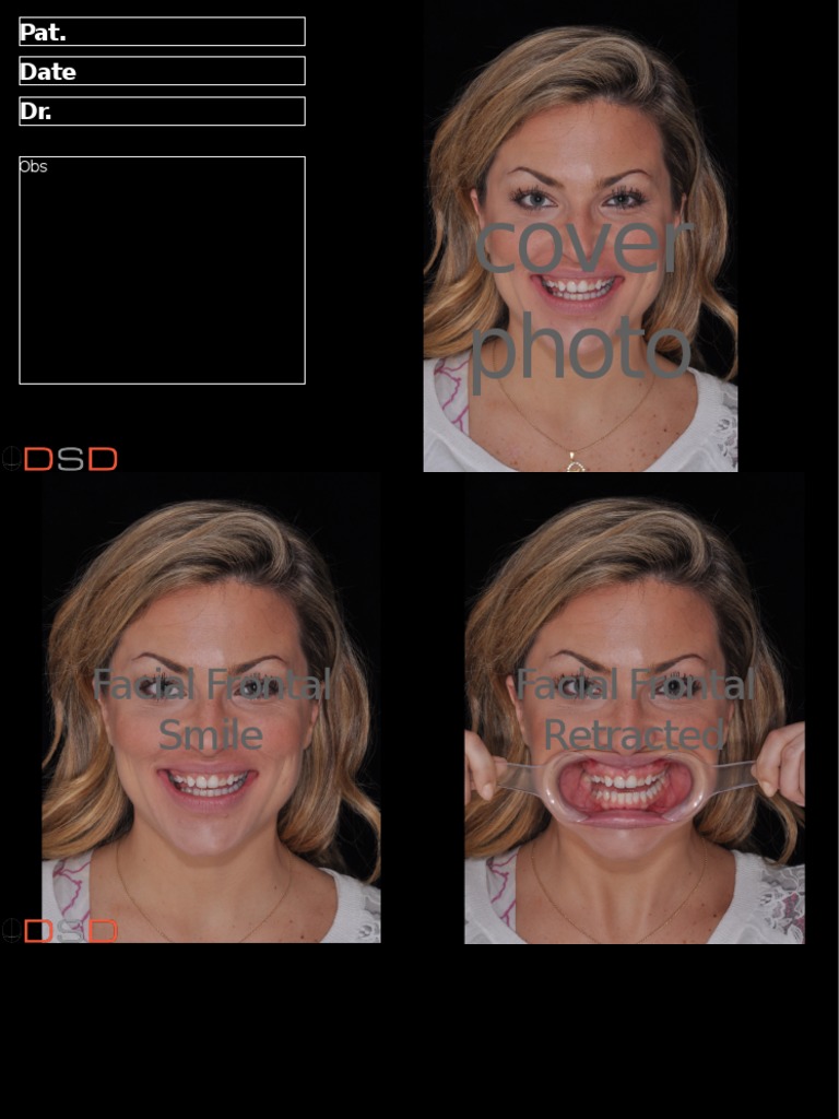 DSD Smile Design Template Overview | PDF | Psychology | Nature