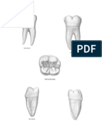 Segundo Molar Inferior