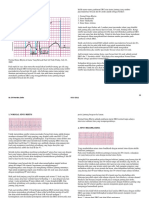 Ekg Semua Sinus