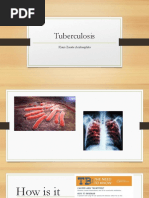 Tuberculosis